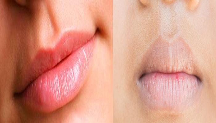 Bikin Bibir Cerah dan Merah Merona Dalam 5 Menit, Hanya dengan Mentega dan Ramuan Ini