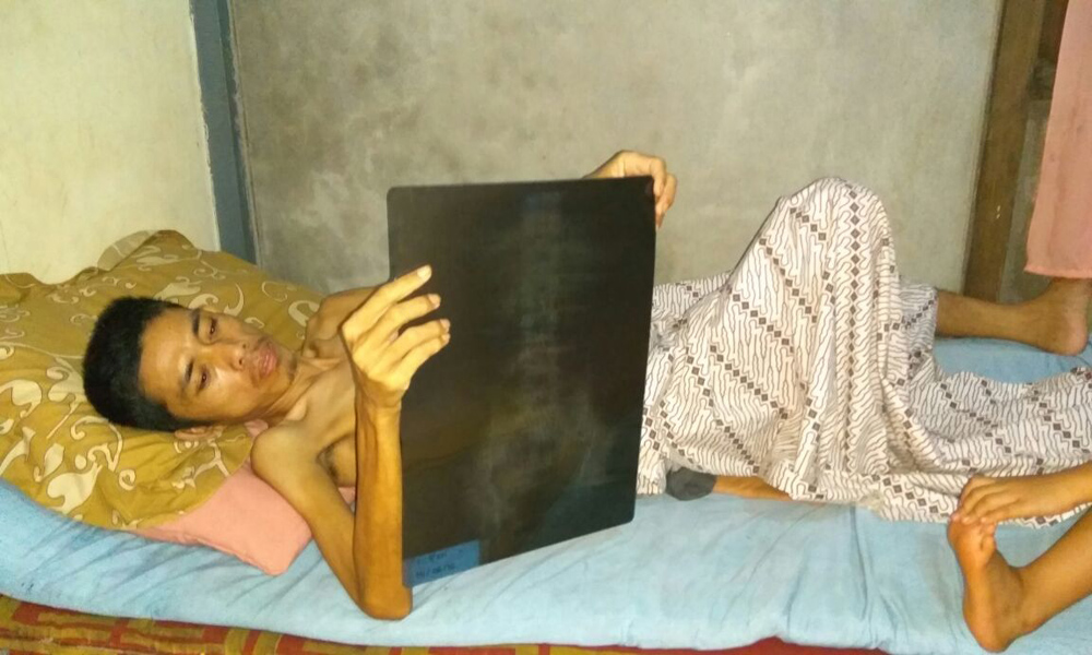 Operasi Gagal, Begini Kondisi Kesehatan Pasien RSUD dr Soedarso ini