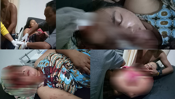 Masalah Asmara Diduga Picu Pembacokan 2 Wanita dan Satu Pria Pekerja Sawit di Kapuas Hulu
