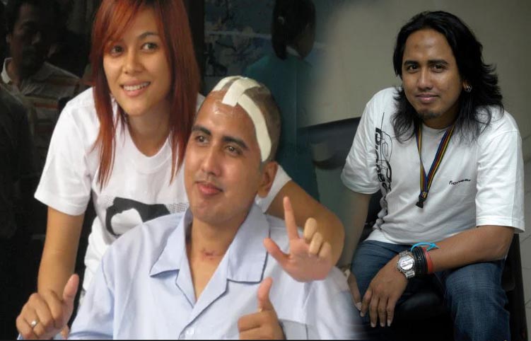 lama-mengidap-tumor-otak-hingga-diceraikan-istrinya-begini-kabar-artis-gugun-gondrong.jpg