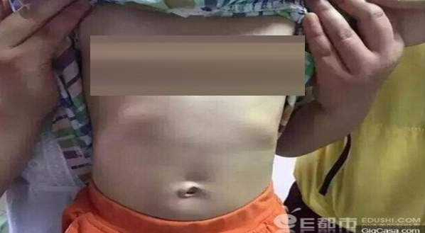 Waduh, Bocah Semungil ini Sudah Menstruasi dan Payudaranya Juga Makin Membesar