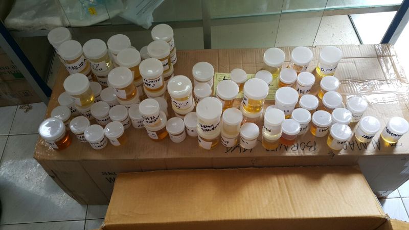 sampel-test-urine-dadakan_20160425_231830.jpg