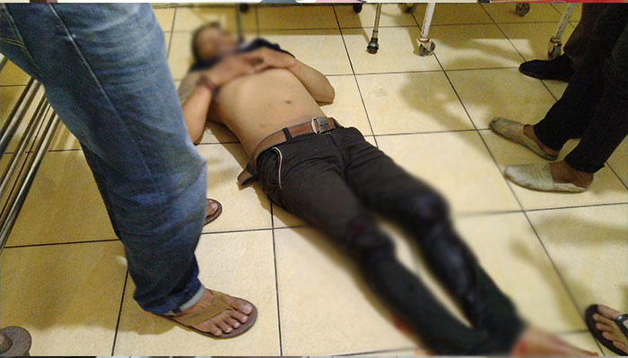 Kembali Lakukan Curanmor, Residivis Ini Dihadiahi Timah Panas di Kedua Kakinya