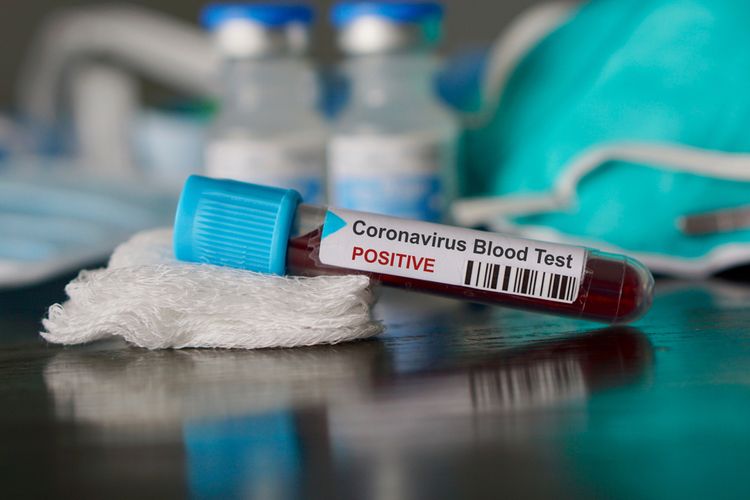 wn-jepang-terinfeksi-virus-corona-sepulang-dari-indonesia-ini-penjelasan-kemenkes.jpg