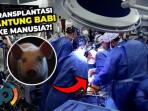 Hati-Babi-Selamatkan-Warga-Hidup-171-Hari-Pasca-Operasi-2025.jpg