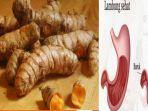 Kunyit-menjadi-obat-herbal-yang-bisa-meredakan-asam-lambung-atau-gerd.jpg