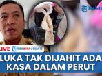 NGERI-Luka-Perut-Tidak-Dijahit-Dipenuhi-Kain-Kasa-usai-Operasi-Warga-Bekasi-Meninggal-2025.jpg
