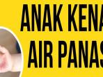 TEGA-Nasib-Ibu-Siram-Anak-Pakai-Air-Panas-Mendidih-di-Ambon.jpg