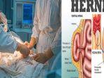 apa-itu-penyakit-hernia-dan-apa-penyebabnya.jpg
