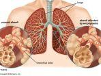apa-penyebab-penyakit-emfisema-gejala-emfisema-nafsu-makan-menurun.jpg
