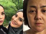 baru-baru-saja-aktris-ini-jadi-korban-malpraktik-wajahnya-yang-cantik-berubah-seperti-ini.jpg