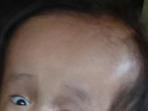 bayi-hydrocephalus_20160121_220509.jpg