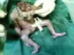 Keajaiban Dunia, Bayi Mirip Kodok