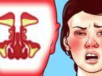ilustrasi-hidung-tersumbat-43333ss.jpg