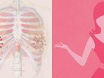 ilustrasi-kanker-payudara-healthline.jpg