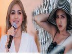 kabar-tak-mengenakan-dari-jessica-iskandar-kekasih-richard-kyle-wajahnya-rusak-tak-lagi-cantik.jpg