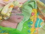 kisah-bayi-lahir-tanpa-tempurung-kepala-lahir.jpg