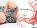 penderita-asam-lambung-ketika-kambuh-saat-tidur.jpg