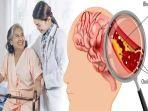 penyebab-stroke-di-usia-muda-adalah-gaya-hidup-yang-buruk-seperti-merokok-dan-minum-alkohol.jpg