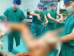 proses-operasi.jpg