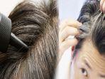 rambut-uban-di-usia-muda-bisa-diatasi-dengan-hindari-penyebabnya.jpg