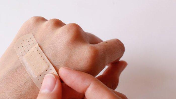 Manfaat Kunyit Dapat Membantu Mempercepat Penyembuhan Luka