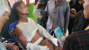 Salah-seorang-korban-insiden-bakar-ban-di-DPRD-SBT-tengah-dirawat-tenaga-medis-RSUD-BULA.jpg