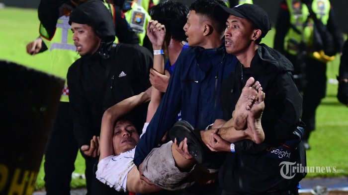 Satu Anak Korban Tragedi Kanjuruhan Kritis di ICU RSSA, Alami Cidera Otak dan Patah Tulang