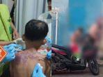 Ibu dan Anak Disiram Air Keras oleh OTK di Sukabumi, Motif dan Pelaku Masih Diselidiki