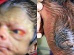 bayi-yang-lahir-dengan-kondisi-tak-biasa.jpg