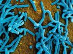 virus-marburg-mdv-penyakit-ini-ditemukan-muncul-lagi-di-afrika.jpg