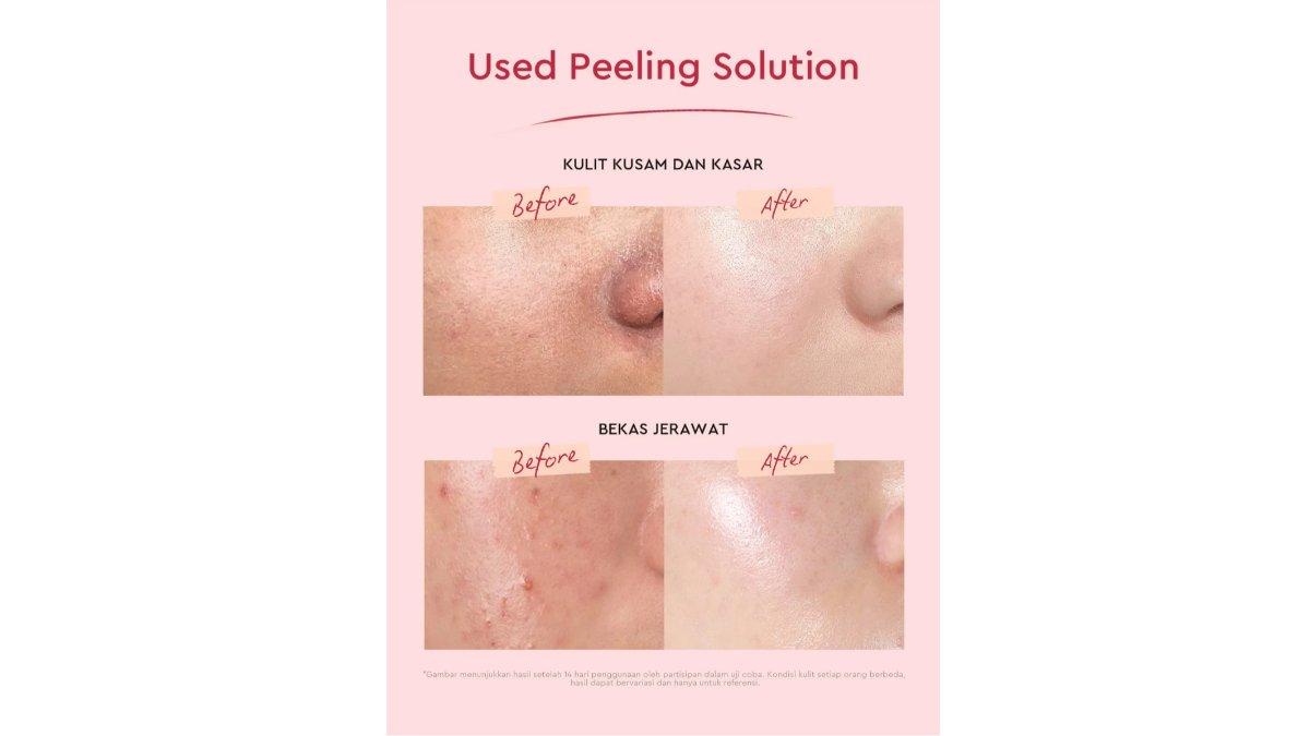 Glad2Glow Peeling Solution Serum