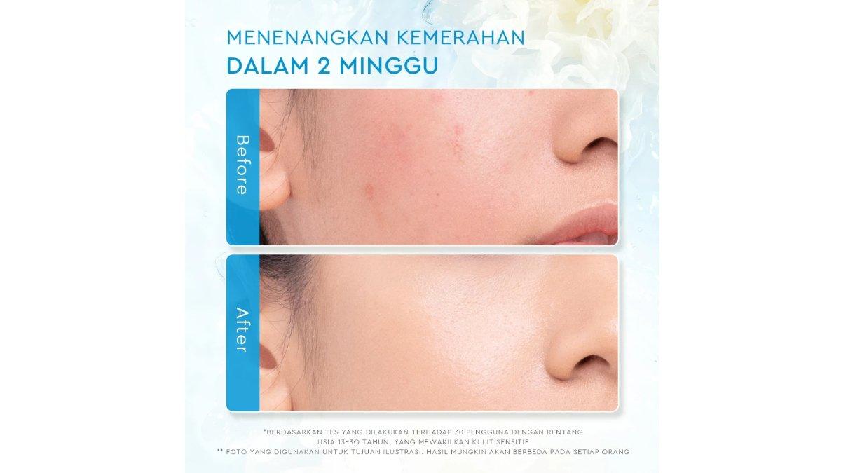 Glad2Glow Tremella Vita B5 Sensitive Calming Moisturizer