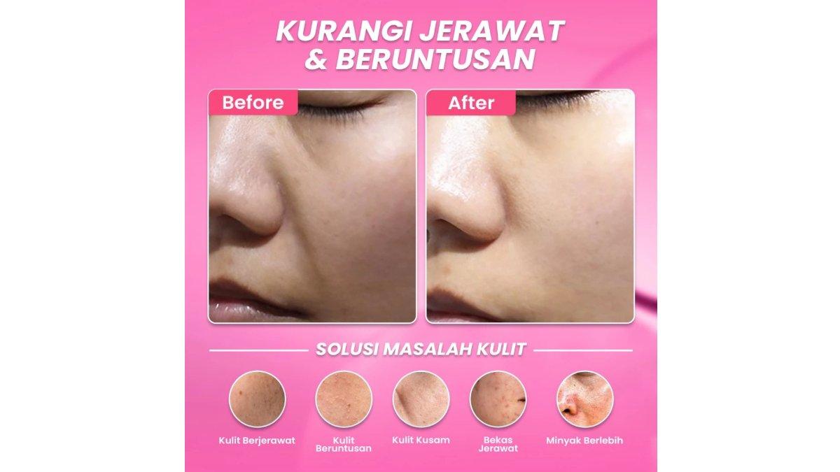 Hanasui Anti Acne Serum