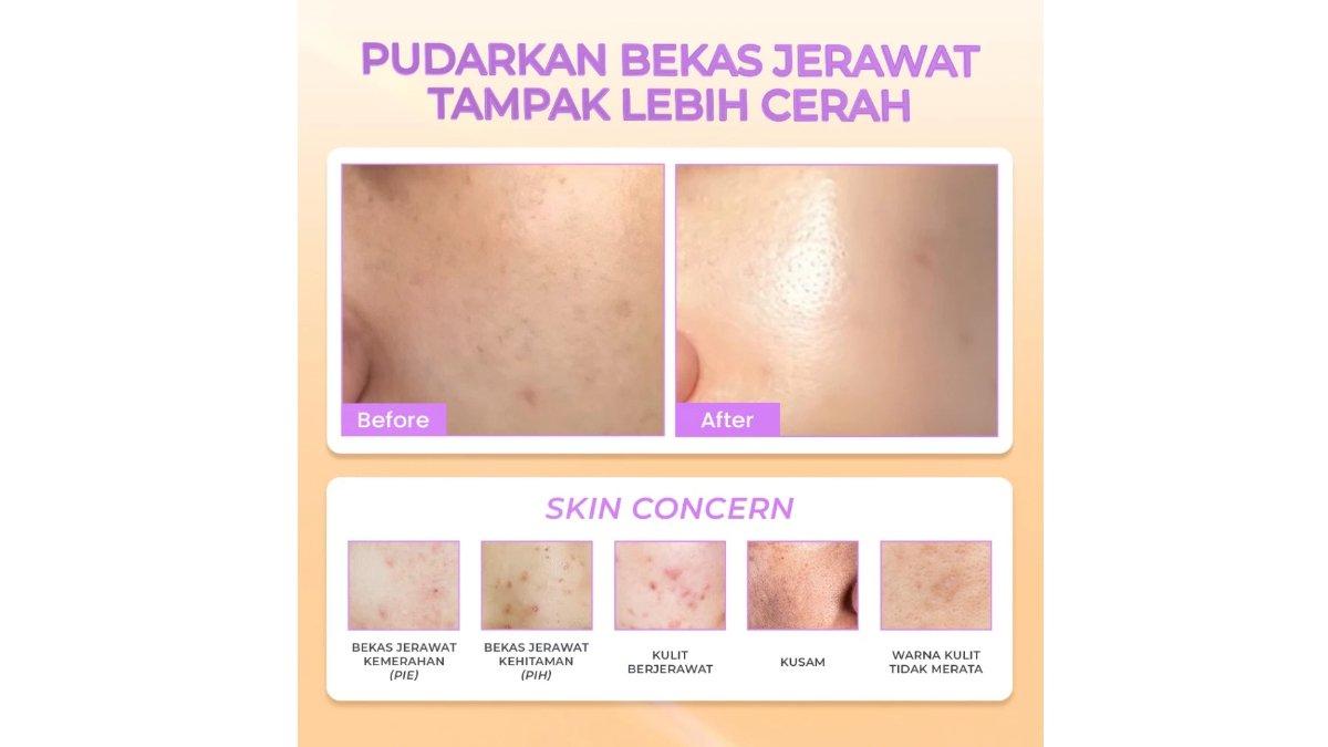 Hanasui Power Post Acne Serum