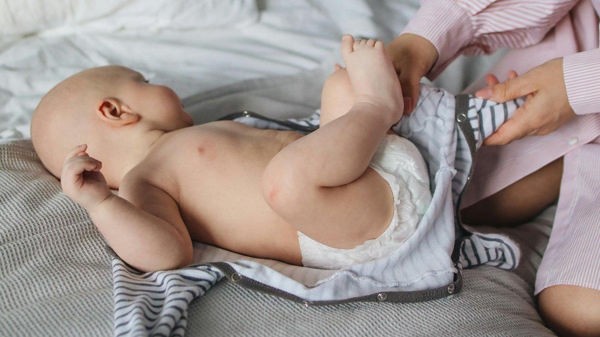 10 Tips Meredakan dan Menghilangkan Bintik-bintik pada Kulit Bayi dengan Aman Tanpa Rasa Sakit