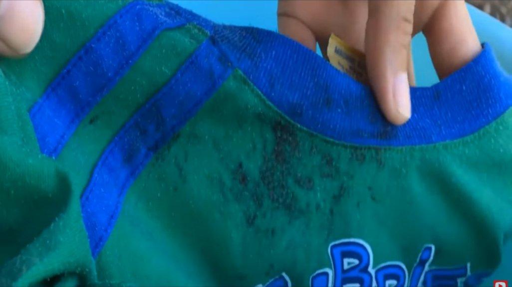 Ilustrasi tips hilangkan noda jamur hitam di baju.