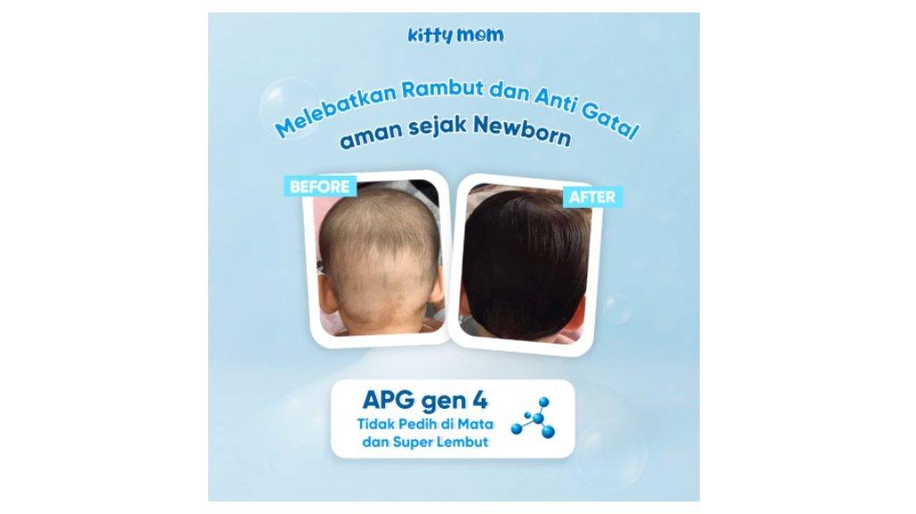 Kitty Mom Shampoo Bayi Anak Menumbuhkan & Melebatkan Rambut