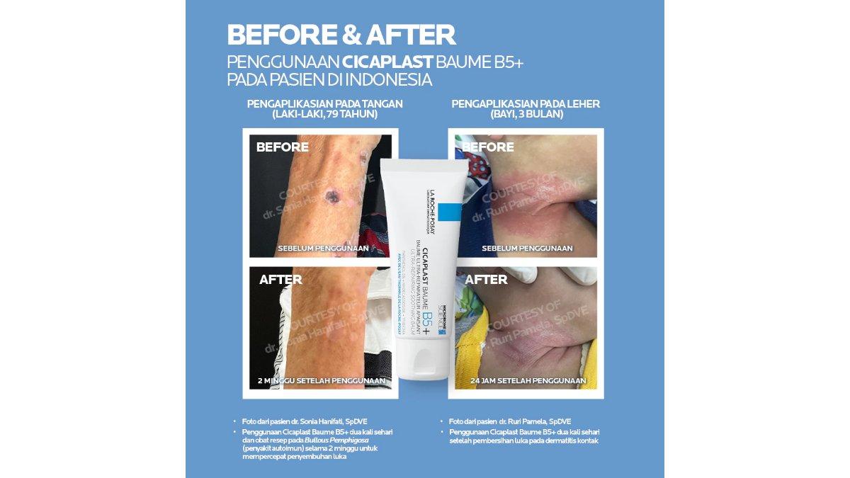 La Roche Posay Cicaplast Baume B5+ Soothing Balm