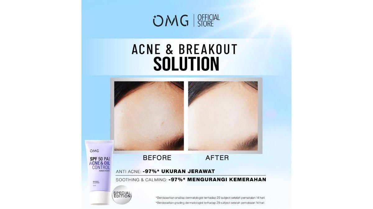 OMG Acne Oil Control UV Barrier Sunscreen SPF50 PA
