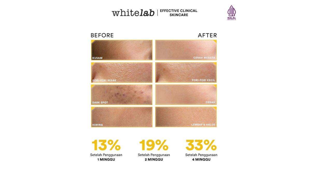 Whitelab Facial Wash Brightening N-Dose+ 2.0