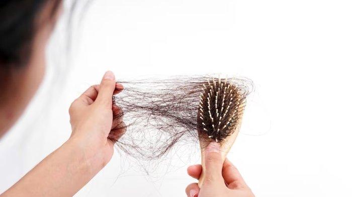 Ilustrasi rambut rontok.