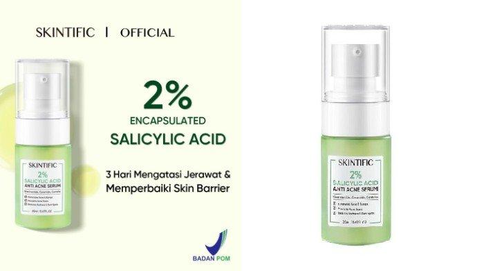 Review SKINTIFIC Anti Acne Serum Acne Spot Treatment Facial Gel, Ampuh mengeringkan Jerawat