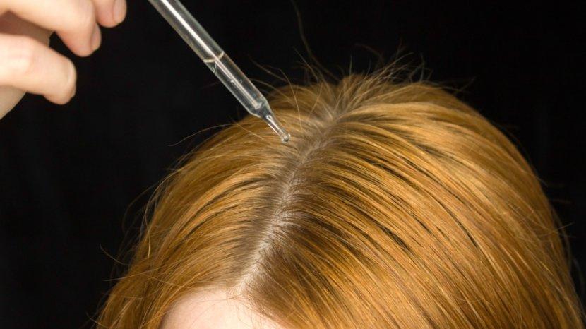 20-Daftar-Hair-Tonic-yang-Memperkuat-Rambut-dari-Kerontokan-srwg.jpg