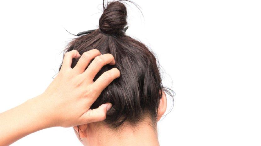 25-Daftar-Shampoo-Anti-Ketombe-yang-Ampuh-Bikin-Kulit-Kepala-Bebas-Gatal.jpg