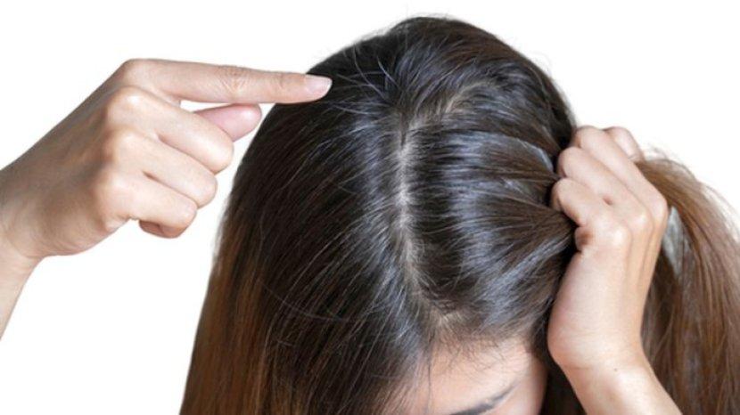 3 Cara Mencegah Rambut Beruban di Usia Muda, Salah Satunya Rutin Makan Buah dan Sayuran Segar