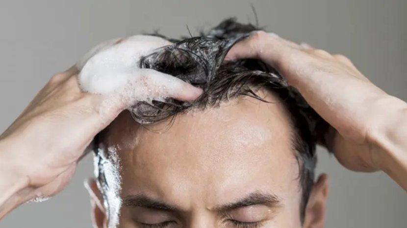 30-Daftar-Shampoo-Penghilang-Ketombe-untuk-Kulit-Kepala-Ekstra-Bersih.jpg