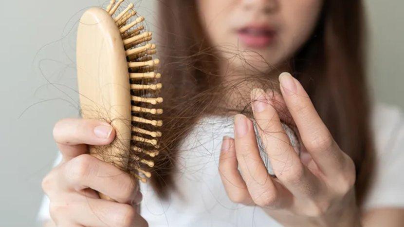 4 Rekomendasi Toner Rambut Rontok Bawah 100 Ribuan