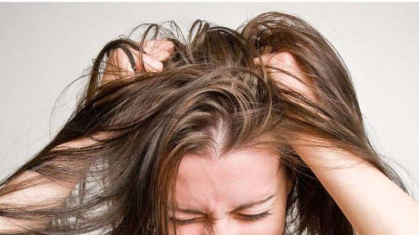 4 Cara Ampuh Menghilangkan Kutu Rambut Menggunakan Garam
