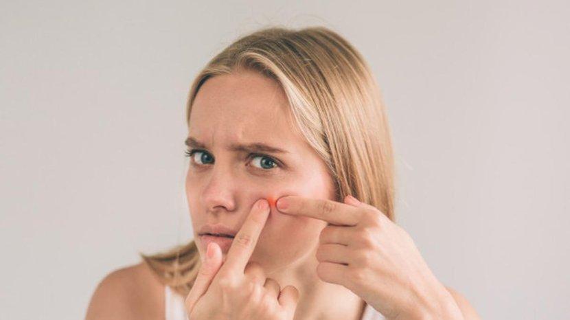5-Rekomendasi-Acne-Spot-Treatment-untuk-Atasi-Jerawat-Kemerahan-yang-Meradang-d.jpg